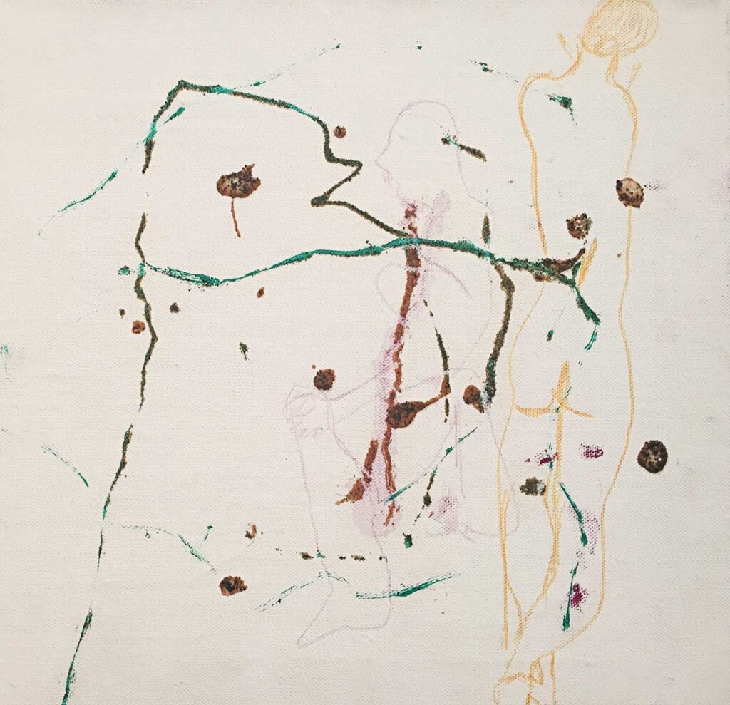 Umbilical Cord 3